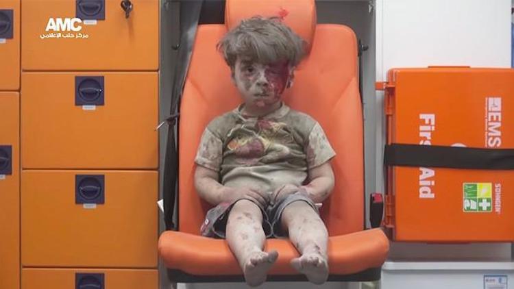 Dünyayı sarsan minik Suriyeli Ümran tek kelime bile konuşmuyor