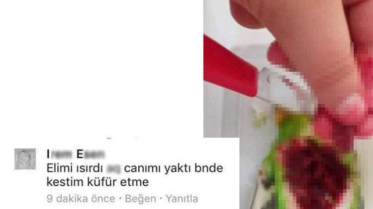 Parmağını ısıran papağanın kalbini söküp Facebooktan paylaştı