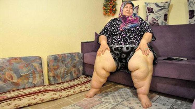 Eşi ölünce hayata küstü, 180 kilo oldu