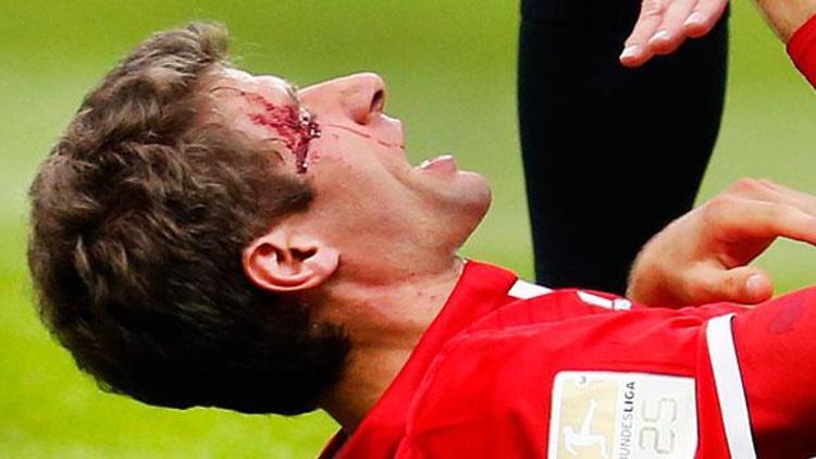 Bayern Münih ağır yaralı