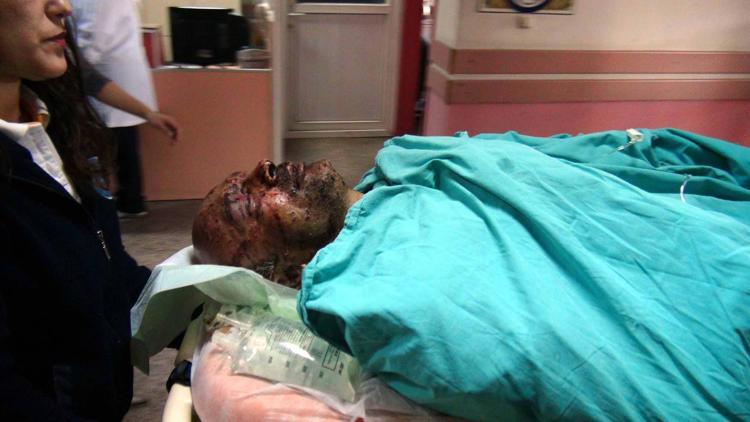 Fethiye’de patlama: 3 yaralı