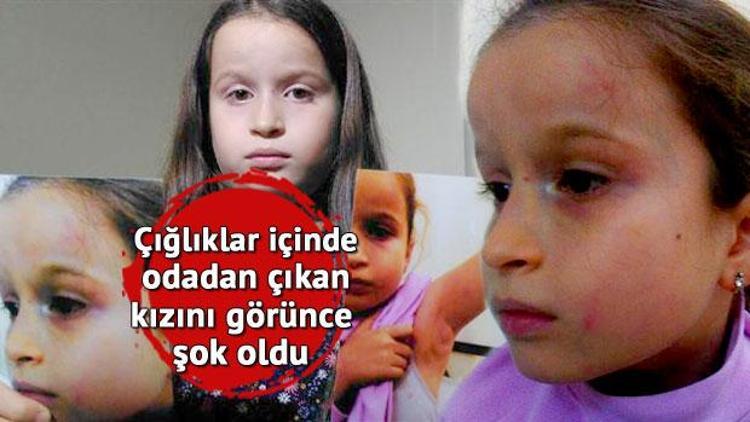 8 yaşındaki İrem’in diş doktoru tarafından darp edildiği iddası