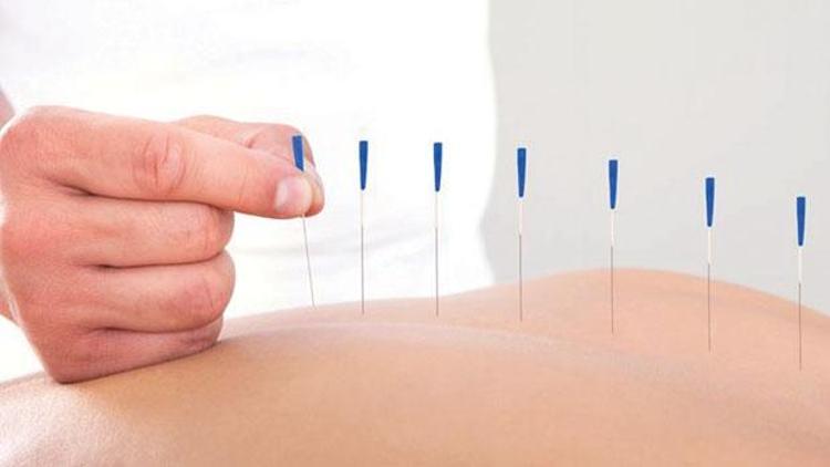 Akupunktur alternatif tıp değil