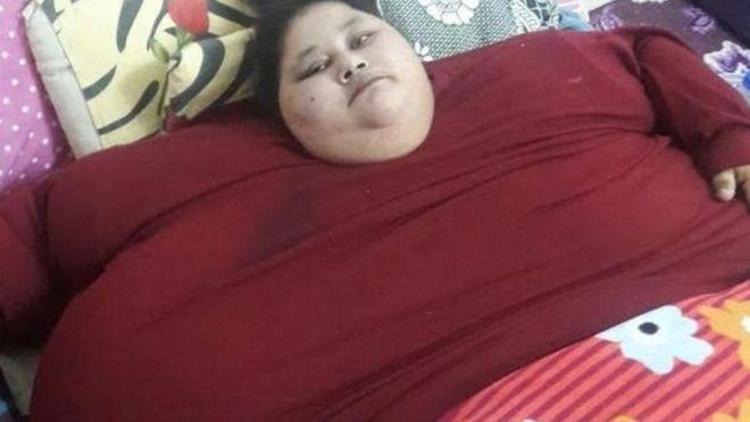 Dünyanın en kilolu kadını ameliyat için Hindistanda