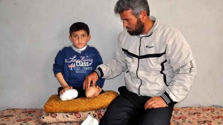 Bacakları kopan Suriyeli Abdulbasit protez istiyor
