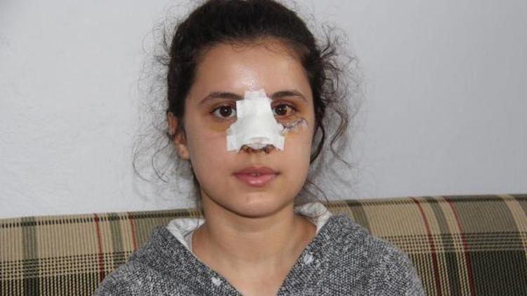 Uyuşturucu bağımlısı, 13 yaşındaki kıza sopayla saldırıp burnunu kırdı