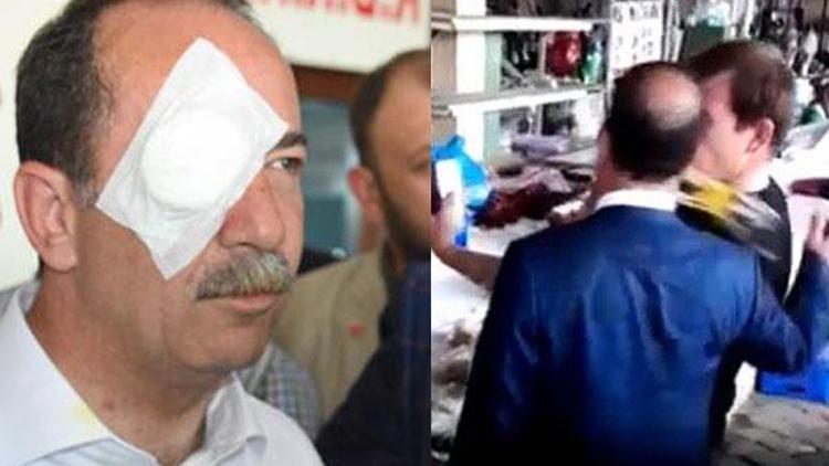 Edirne Belediye Başkanına saldıran kişi tutuklandı