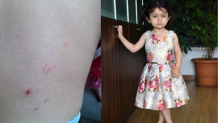 Kreşte vahşet 2.5 yaşındaki kızı dövdü