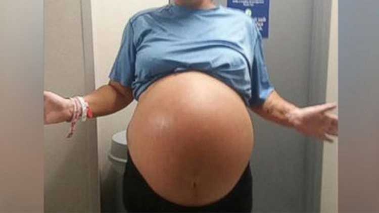 5.8 kilogram ağırlığında bebek dünyaya getirdi