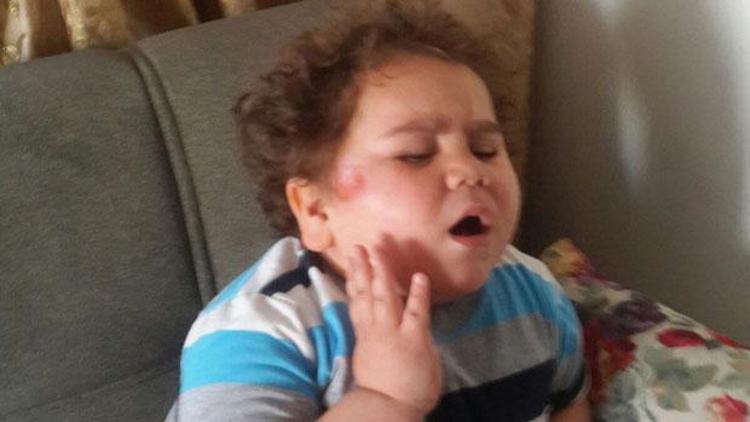 Çitos Efe’ye nazar değdi, trafik kazasında yaralandı
