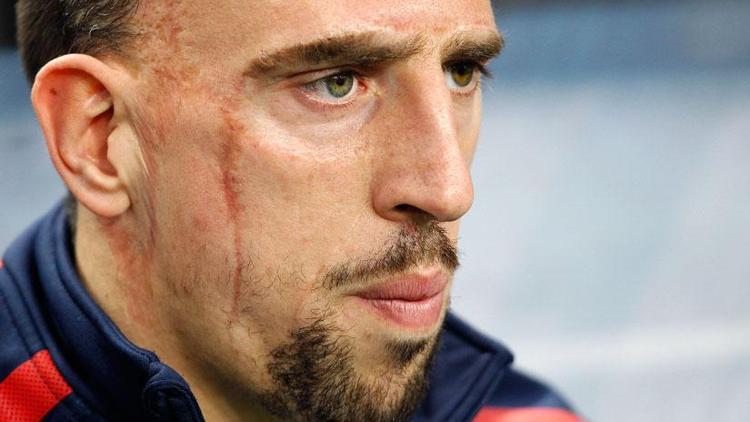 O sürpriz Ribery... Efsane geri dönüyor