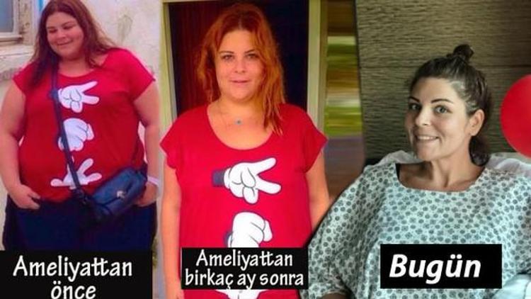 22 ayda 90 kilo veren Pelin Öztekin yeniden ameliyat oldu