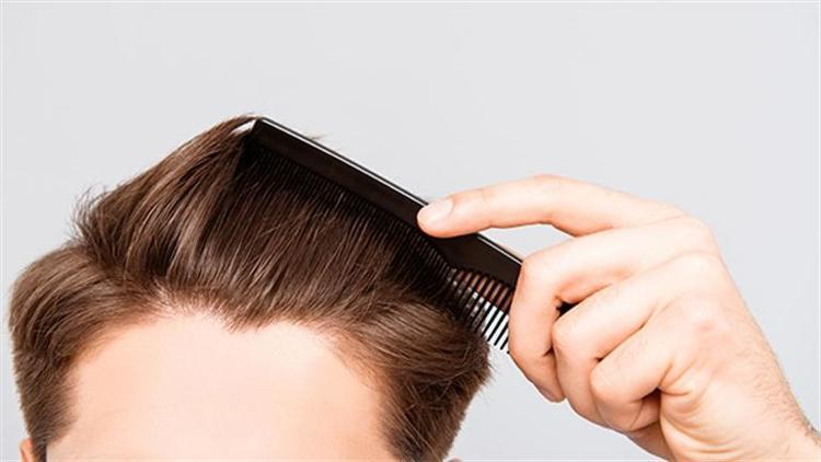 DHI saç ekimine nasıl hazırlanılır