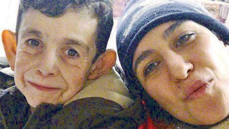 Suriyeli ‘Benjamin Button’ın hayatı  bir fotoğrafla nasıl değişti