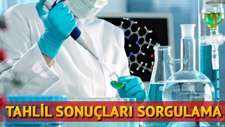 Tahlil sonuçları sorgulama ekranı Tahlil sonuçlarınızı öğrenin