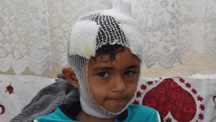 8 yaşındaki Mahmut, sokak köpeklerinin saldırısına uğradı