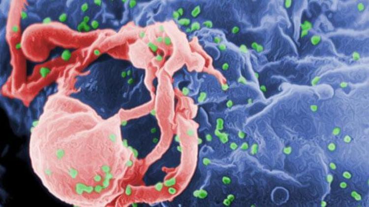 HIV virüsü nedir