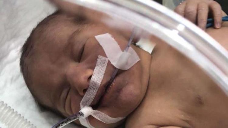 Kalp rahatsızlığı olan bebek ambulans uçakla İstanbula sevk edildi