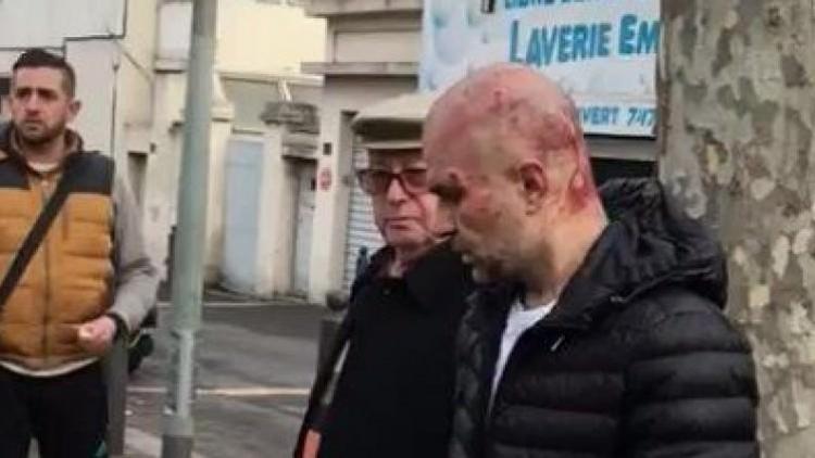 Ayıp Fransa’da  PKK yandaşları Türklere saldırdı polis seyirci kaldı