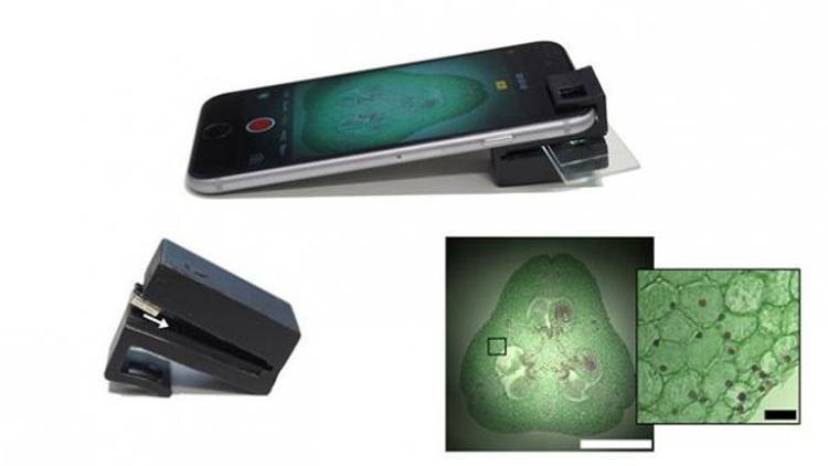 Optik eklenti cep telefonunu mikroskoba dönüştürüyor