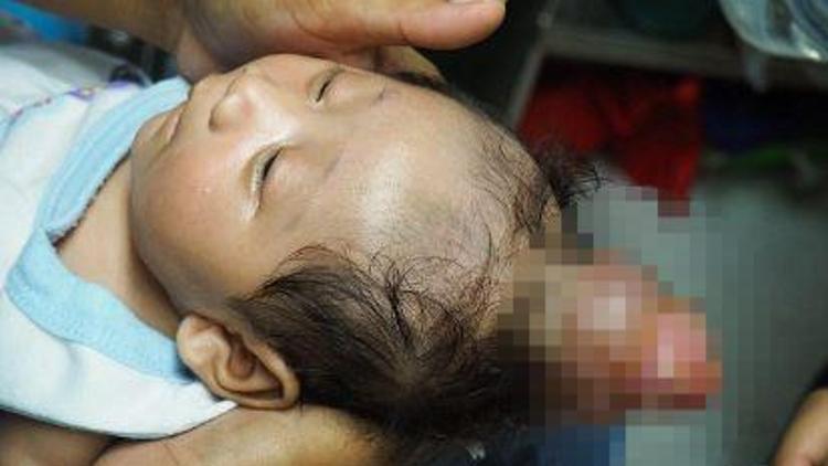 Filipinlerde boynuzlu bebek görenleri şaşkına çevirdi