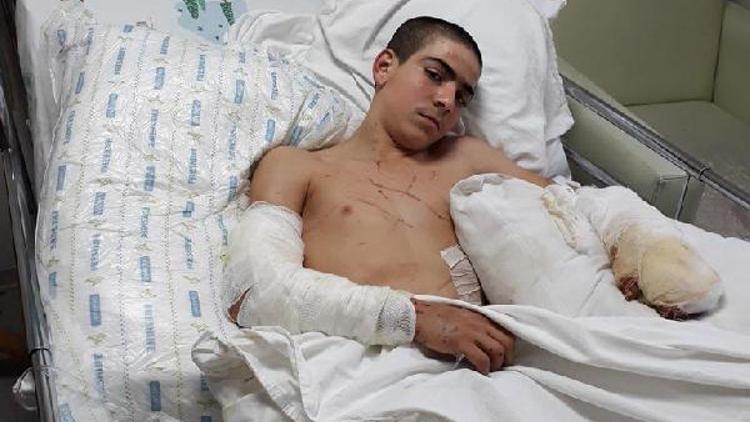 Pitbull saldıran çocuk ağır yaralandı