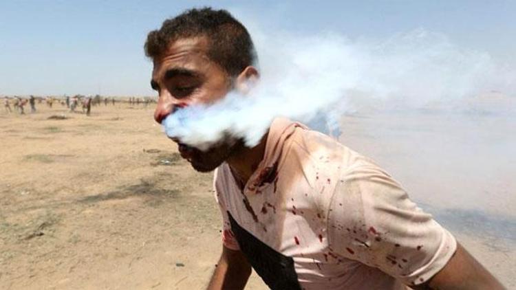 Ağzına gaz bombası isabet eden Filistinli’nin sağlık durumu belli oldu