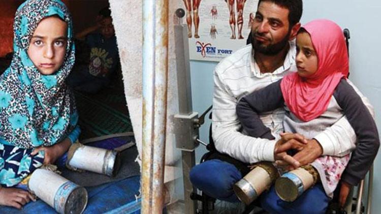 Suriyeli Maya protez tedavisi için İstanbulda
