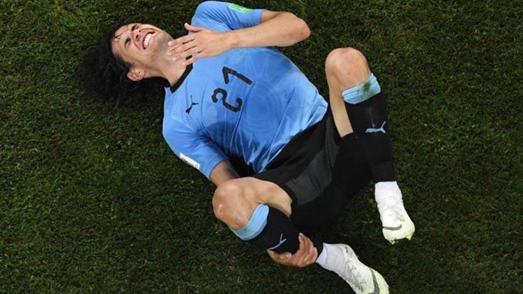 Edinson Cavanide son durum...