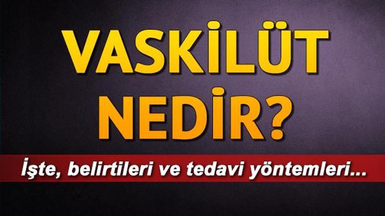 Vaskülit nedir Vaskülit tedavisi nasıl yapılır