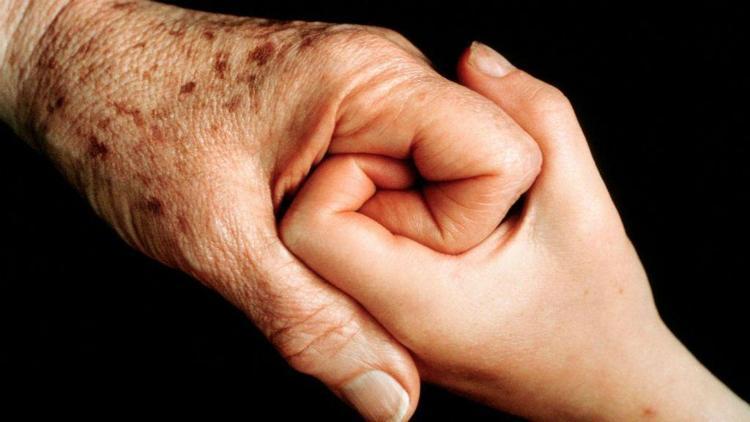 Yaşlılık lekesi nasıl geçer Yaşlılık lekesi tedavisi nelerdir