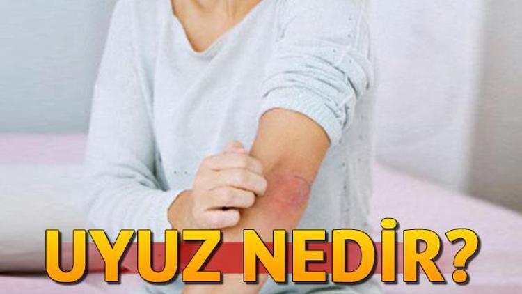 Uyuz hastalığı nedir Uyuz belirtileri neler