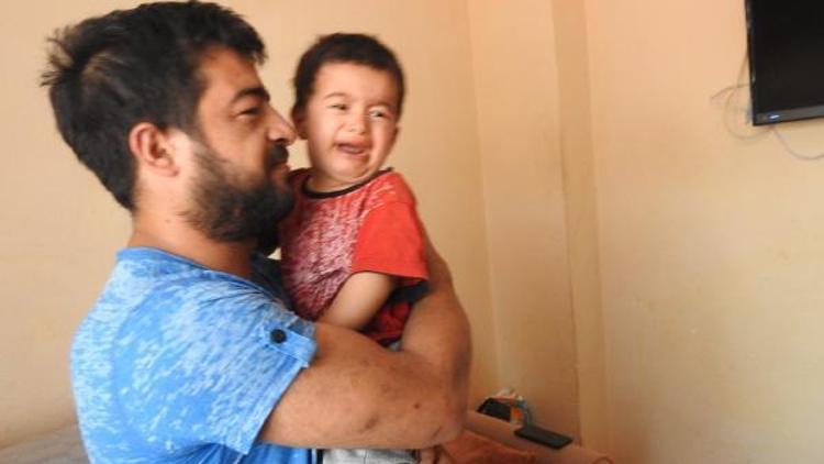 2 yaşındaki Ahmet Muhammed, düdüklü tencereye sıkıştı (2)