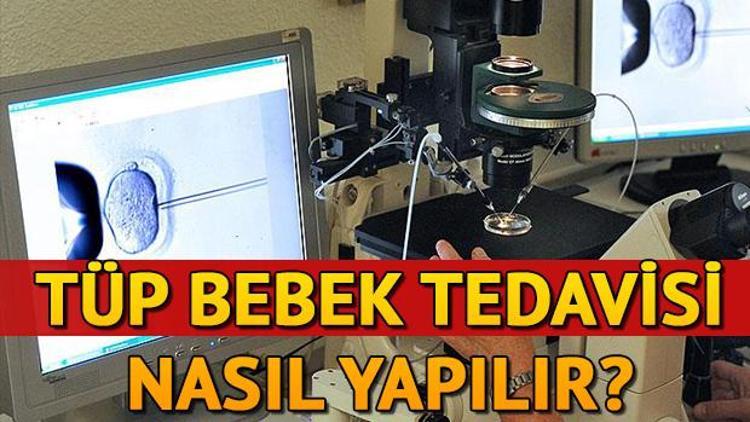 Tüp bebek tedavisi nedir Tüp bebek tedavisi nasıl yapılır