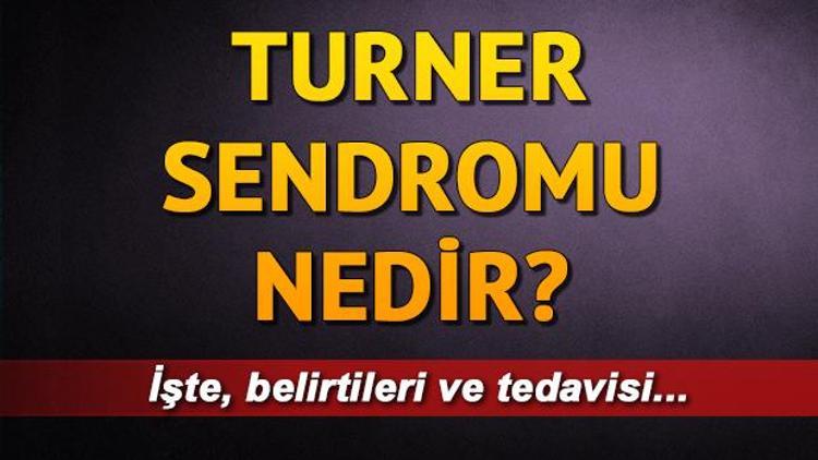 Turner sendromu nedir Turner sendromu tedavisi