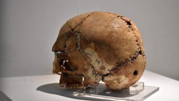 10 bin yıl önce ilk beyin ameliyatı yapılan kafatasına yoğun ilgi