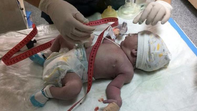 16 günlük Ömer bebek yaşam savaşı veriyor