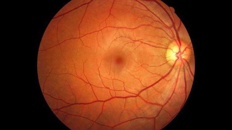 Görme bozukluklarının tedavisi için retina üretildi