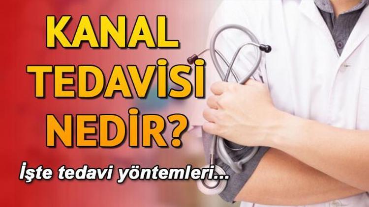 Kanal Tedavisi nedir ve nasıl yapılır