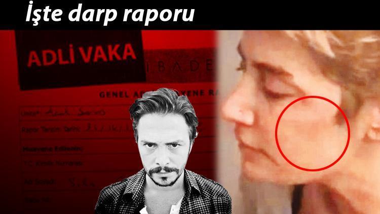 Sılanın darp raporu ortaya çıktı: Korkunç detaylar