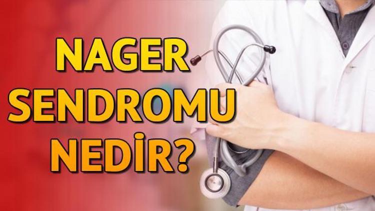 Nager sendromu nedir Dünya üzerine çok az kişide görülüyor