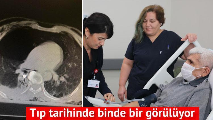 Tıp tarihinde binde bir görülüyor: Gittiği düğünde ölümden döndü