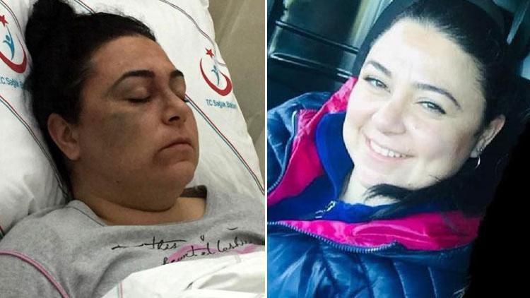 Antalyada akılalmaz olay Tanımadığı 3 kadını döverek hastanelik etti