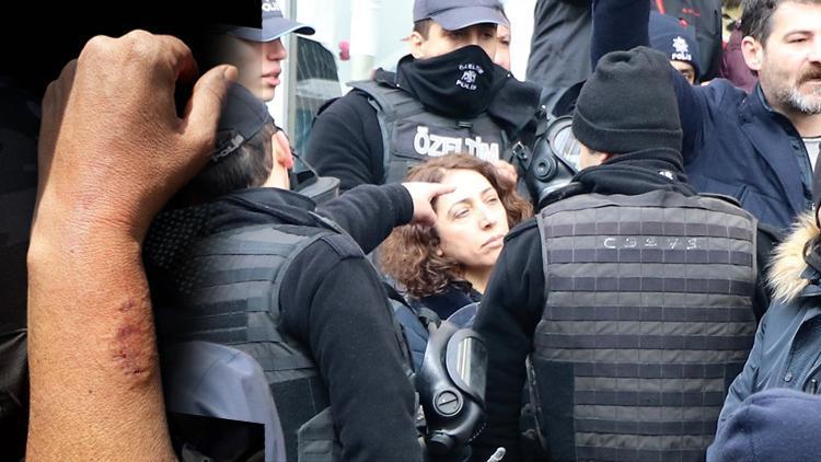 HDPli milletvekili polis memurunun kolunu ısırdı