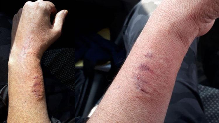 Polisin kolunu ısıran HDPli vekil hakkında flaş gelişme