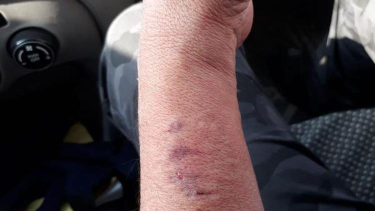 Kadın polisin kolunu ısıran HDPli Aydenize soruşturma