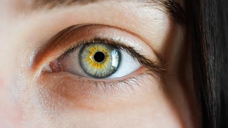 Göz altı morlukları neden olur