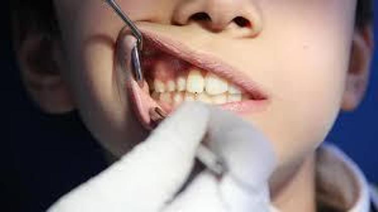 Diş fırçalamak orucu bozar mı Diş çektirmek orucu etkiler mi