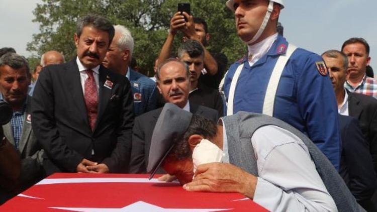 Ankarada tedavi gören güvenlik korucusu, 12 gün sonra şehit oldu