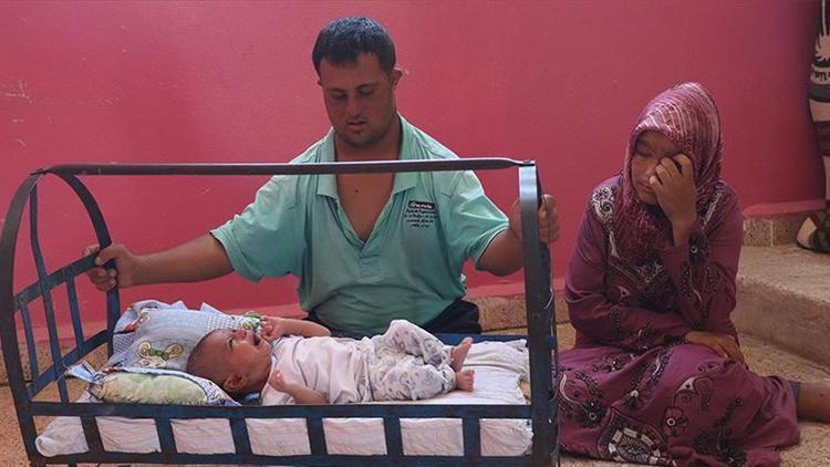 Suriyede mucize bebek yardım bekliyor